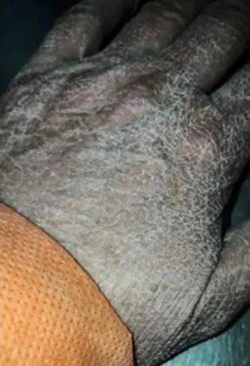 Conmovedora foto de la mano de Mónica ( Facebook).