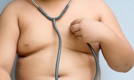 obesidad y sobrepeso, dos ejes de una epidemia social obesidad y sobrepeso, dos ejes de una epidemia social
