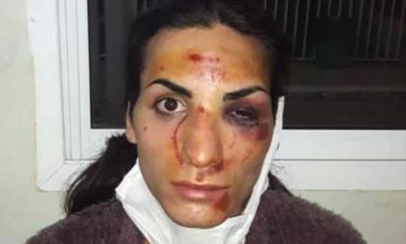Agredieron a patadas a una chica trans en San Pedro Agredieron a patadas a una chica trans en San Pedro