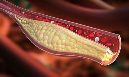 Una parte del colesterol se produce internamente y no proviene de los alimentos. Una parte del colesterol se produce internamente y no proviene de los alimentos.
