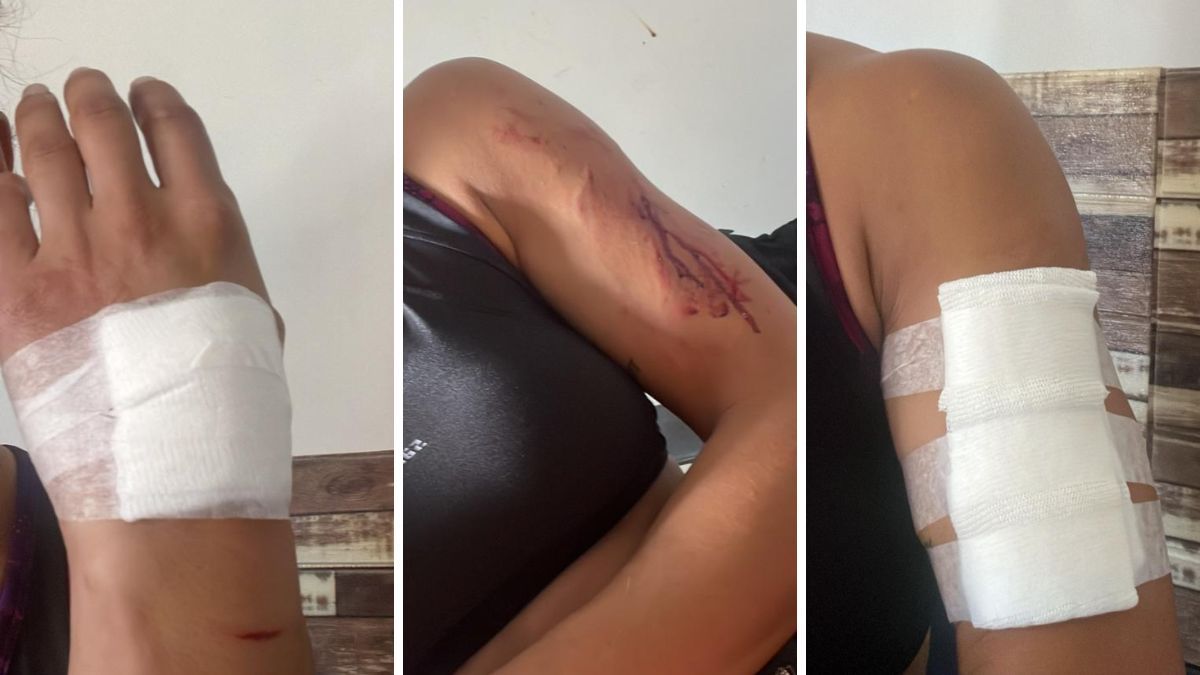 La mujer presenta lesiones en distintas partes de su cuerpo.