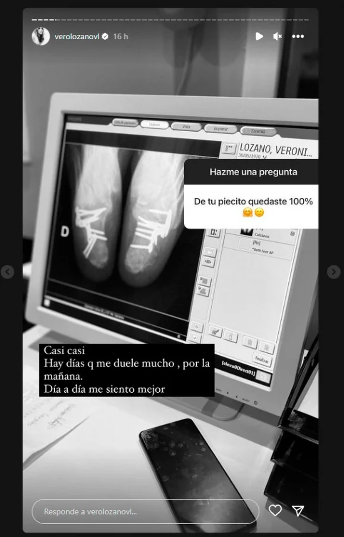 Verónica Lozano fue operada de sus pies tras la caída de la aerosilla.