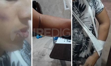 Kevin tiene 22 años y fue brutalmente golpeado por una pareja de ladrones, frente al Cementerio Municipal. Kevin tiene 22 años y fue brutalmente golpeado por una pareja de ladrones, frente al Cementerio Municipal.