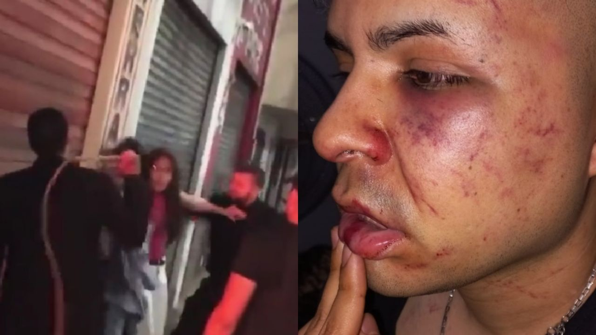 Agresión en Tucumán: patovicas atacaron con un látigo a dos jóvenes en la puerta de un boliche