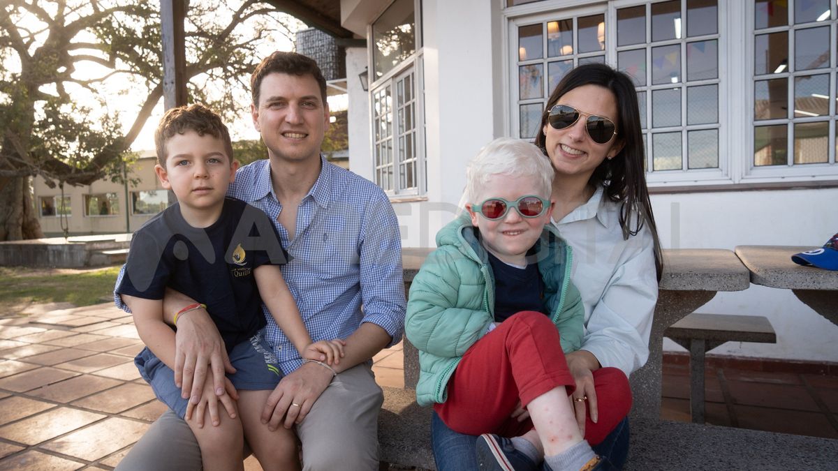 Gonzalo Falbo e Ivana Saliva son padres de Emanuel, de cuatro años, y Tomi de dos y medio. Desde que nació Tomi, conviven con el albinismo. Gonzalo Falbo e Ivana Saliva son padres de Emanuel, de cuatro años, y Tomi de dos y medio. Desde que nació Tomi, conviven con el albinismo.
