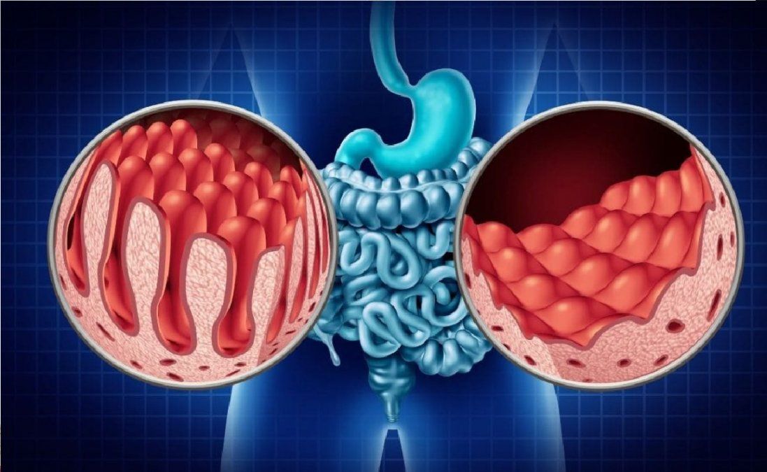El alimento ideal para personas celíacas