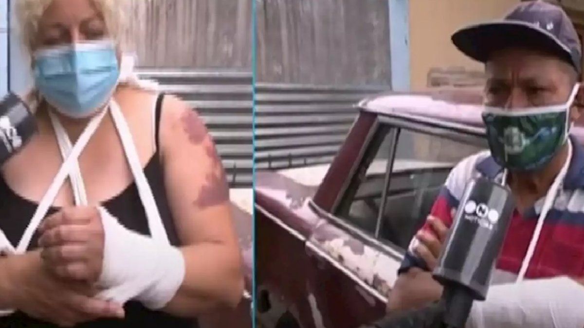 Un pitbull mordió a cinco vecinos y un policía tuvo que matarlo