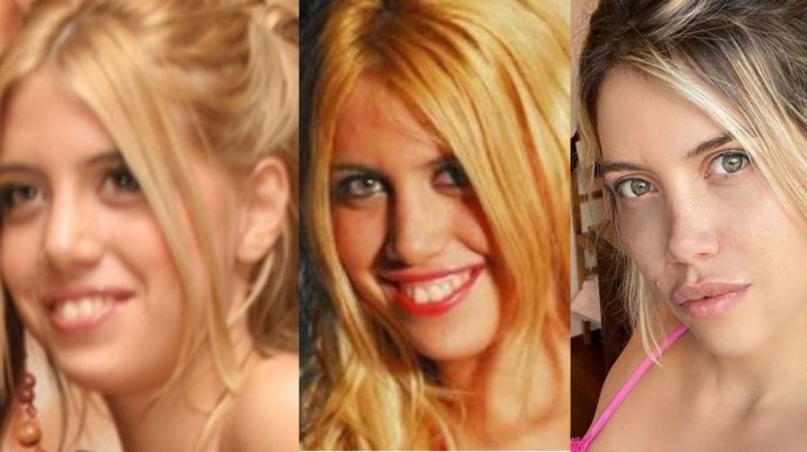 Wanda Nara dice que no se hizo cirugías estéticas y que tampoco se hará.