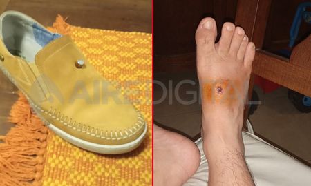 Un vecino del barrio María Selva terminó herido en la nochebuena por una bala perdida. Un vecino del barrio María Selva terminó herido en la nochebuena por una bala perdida.