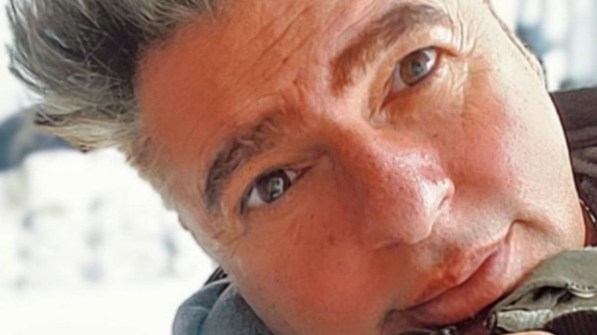 Así quedó Daniel Ambrosino tras superar una cirugía que le hicieron por un delicado problema de salud