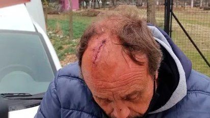 Tras el ataque, el hombre de 60 años sufrió un traumatismo de cráneo y una herida cortante en esa zona de unos 10 centímetros, por lo que tuvo que ser derivado al Hospital Municipal para su sutura. En tanto, el agresor que en una primera instancia fue trasladado en un patrullero a la Comisaría Séptima, ya fue liberado.&nbsp;