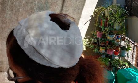 La mujer recibió dos golpes con una botella y debieron darle tres puntos de sutura. La mujer recibió dos golpes con una botella y debieron darle tres puntos de sutura.
