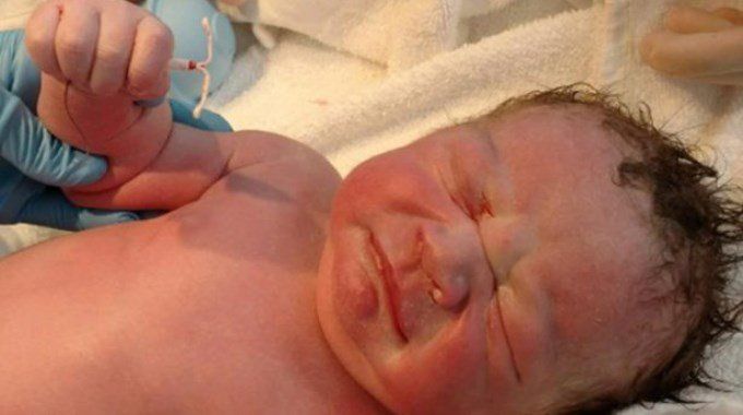 Bebé nació con DIU fallido entre sus manos
