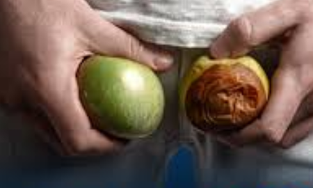 El scrotox promete mejorar la apariencia del escroto. El scrotox promete mejorar la apariencia del escroto.