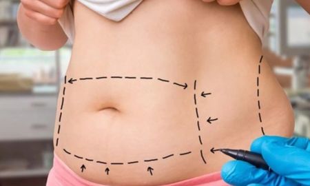 La víctima del caso era oriunda de Rafaela y murió tras realizar una lipoaspiración. La víctima del caso era oriunda de Rafaela y murió tras realizar una lipoaspiración.