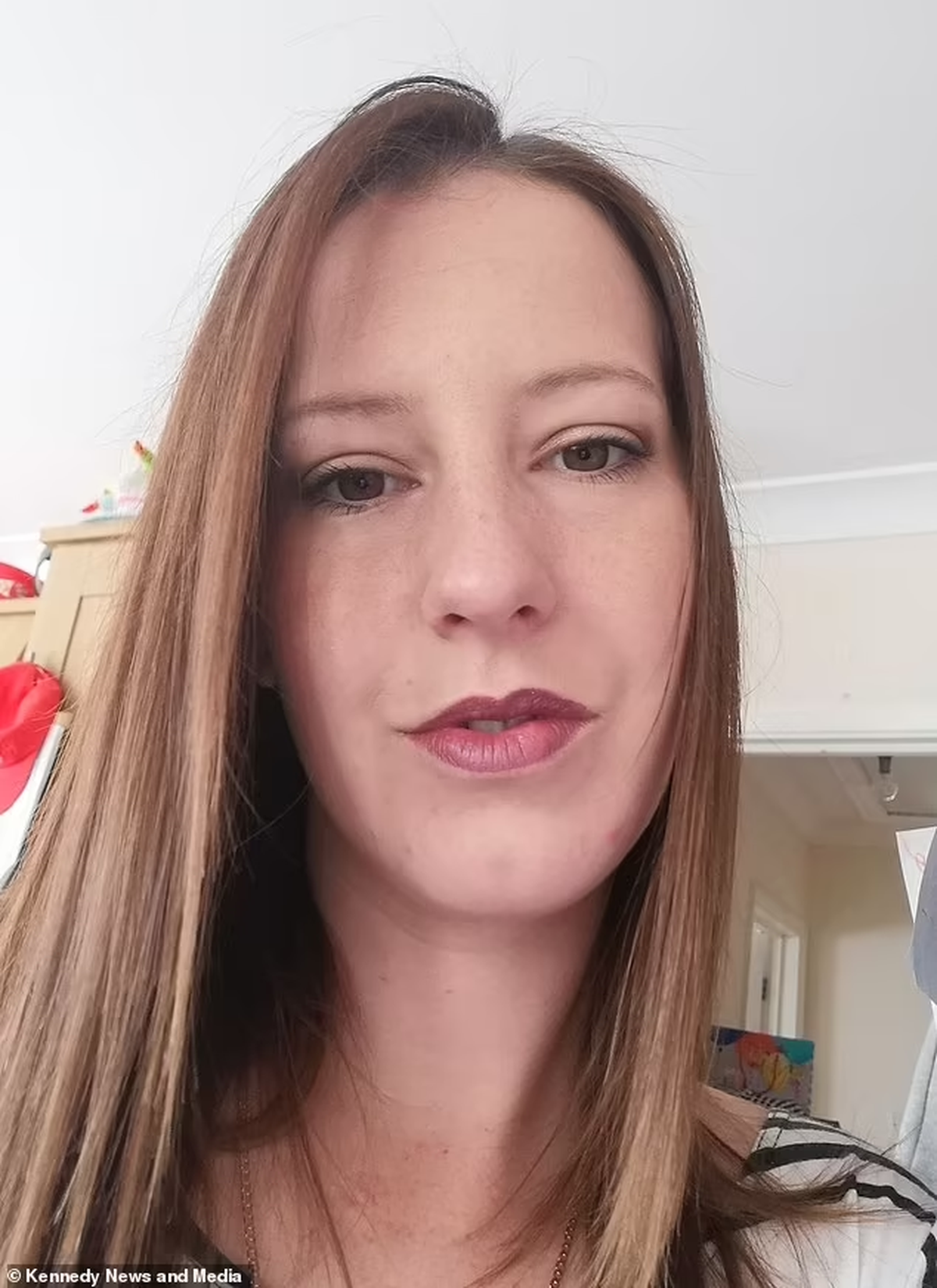 Stacey Grimes, de 33 años, dice que casi pierde la pierna después de que una araña la picara en un festival de música.