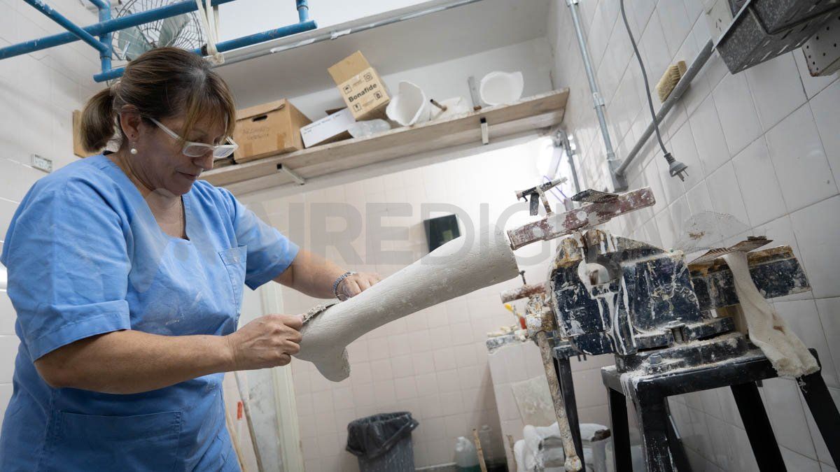 El hospital Vera Candioti tiene un taller de ortesis y prótesis. El hospital Vera Candioti tiene un taller de ortesis y prótesis. 