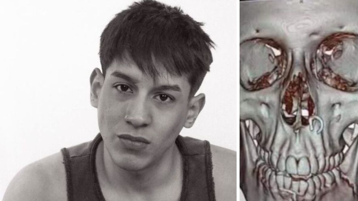 La víctima recibió asistencia médica tras el ataque homofóbico en Palermo.