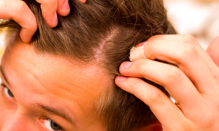 Cómo cuidar el cabello en adolescentes: los problemas más comunes y sus soluciones Cómo cuidar el cabello en adolescentes: los problemas más comunes y sus soluciones