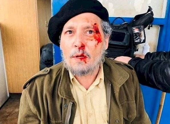 El envenenamiento se dio debido al consumo de mariscos y pescado en la región, lo cual provocó la prohibición de la pesca en esta área hasta 1997. / Instagram