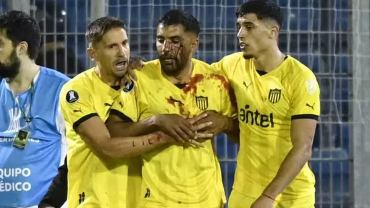 El hincha de Rosario Central que agredió al futbolista de Peñarol