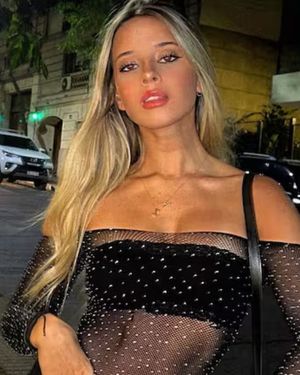 Zoe Bogach compartió en sus redes las primeras imágenes tras pasar por el quirófano para una cirugía estética. Zoe Bogach compartió en sus redes las primeras imágenes tras pasar por el quirófano para una cirugía estética.