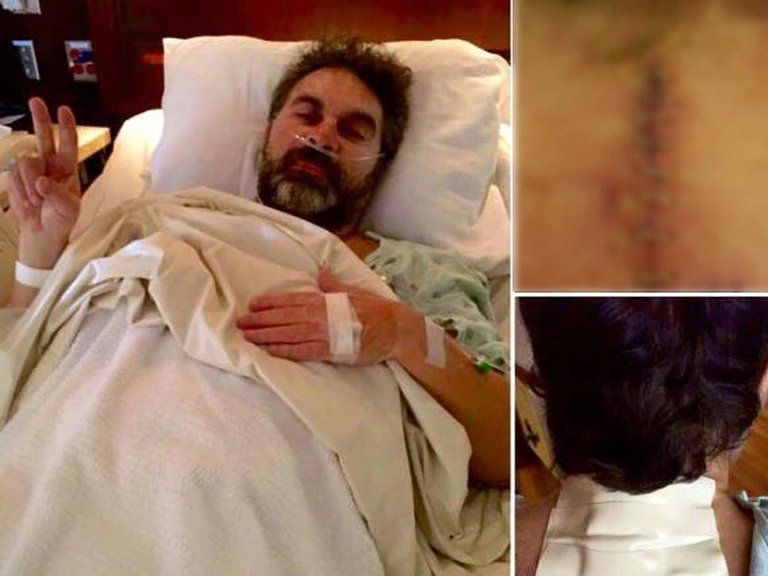 Mijares fue intervenido en la columna, en 2016.