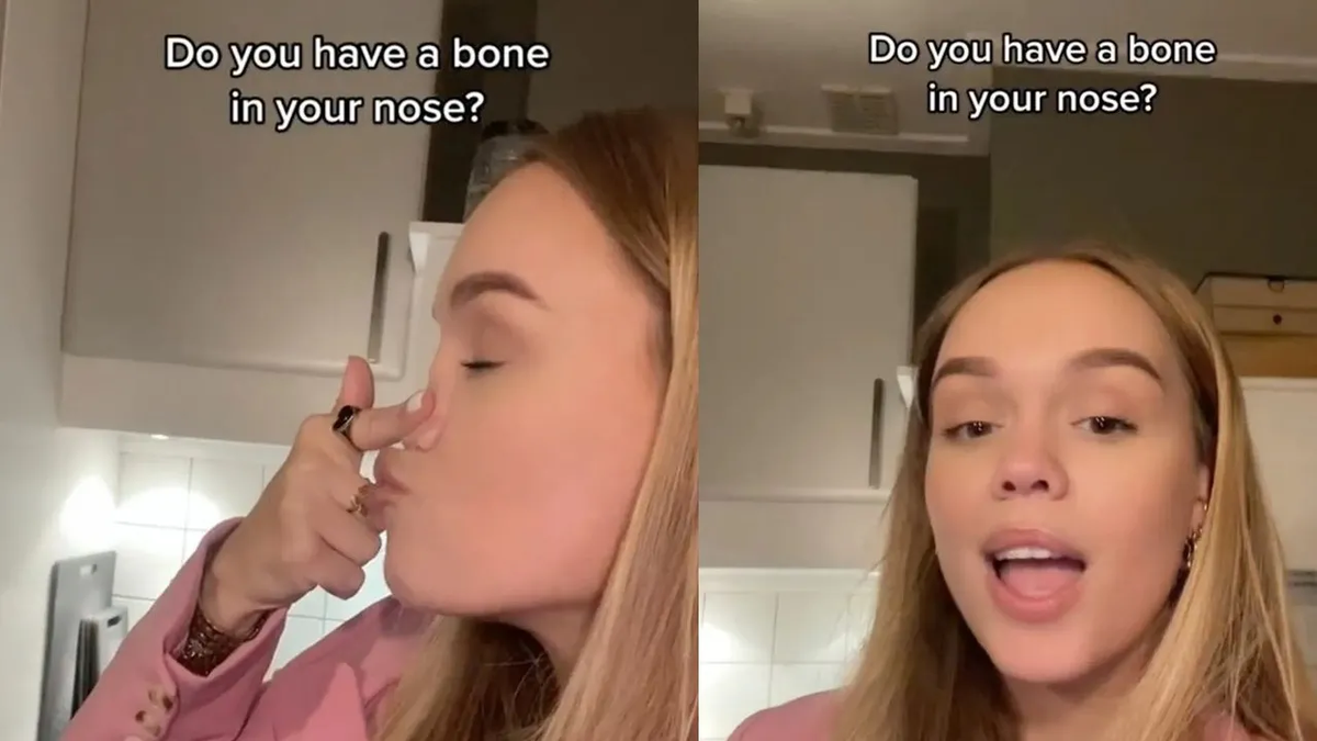 Una usuaria de TikTok se volvió viral y recibió cientos de críticas por su condición.