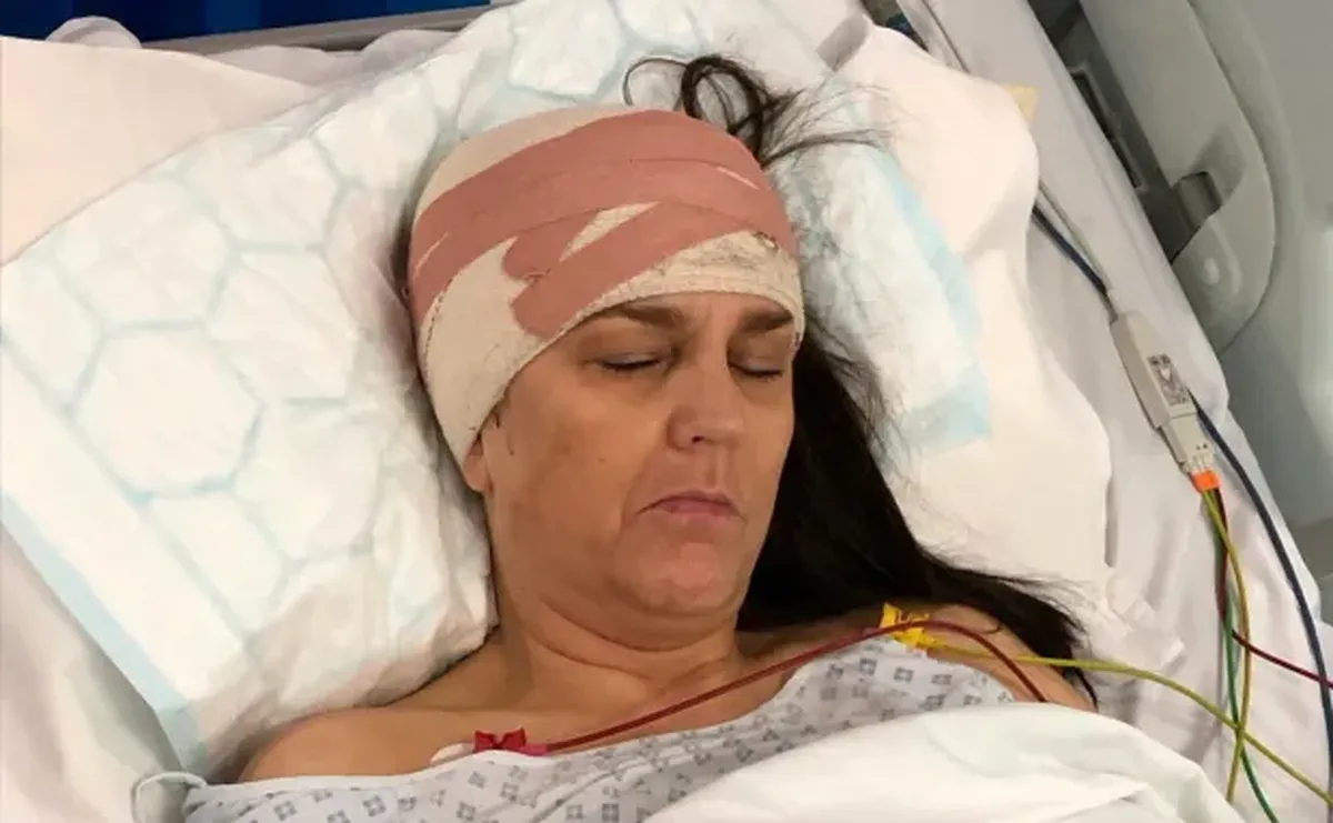 Los médicos encontraron un tumor creciendo en el cerebro de Denise, quien requirió cirugía y quimioterapia. Los médicos encontraron un tumor creciendo en el cerebro de Denise, quien requirió cirugía y quimioterapia.