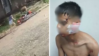 Bestial cierre de año en Santa Fe: un hombre con hundimiento de cráneo y tres heridos en Barranquitas