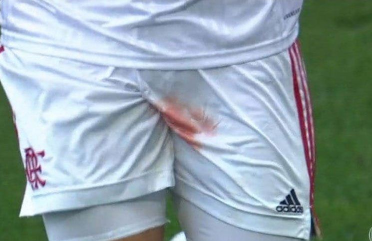 Le pisaron los testículos en el medio del partido, salió con el pantalón ensangrentado y el video se hizo viral