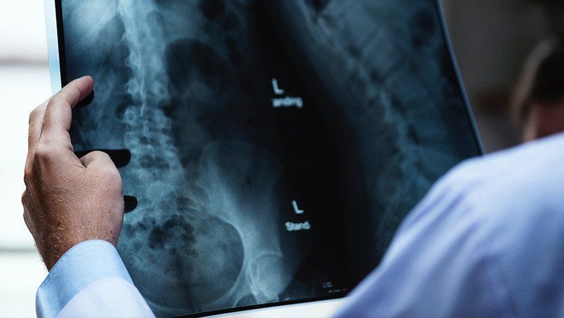 Juguetes, crayones, bolas de golf y otros objetos ‘olvidados’ por pacientes dentro de sus cuerpos