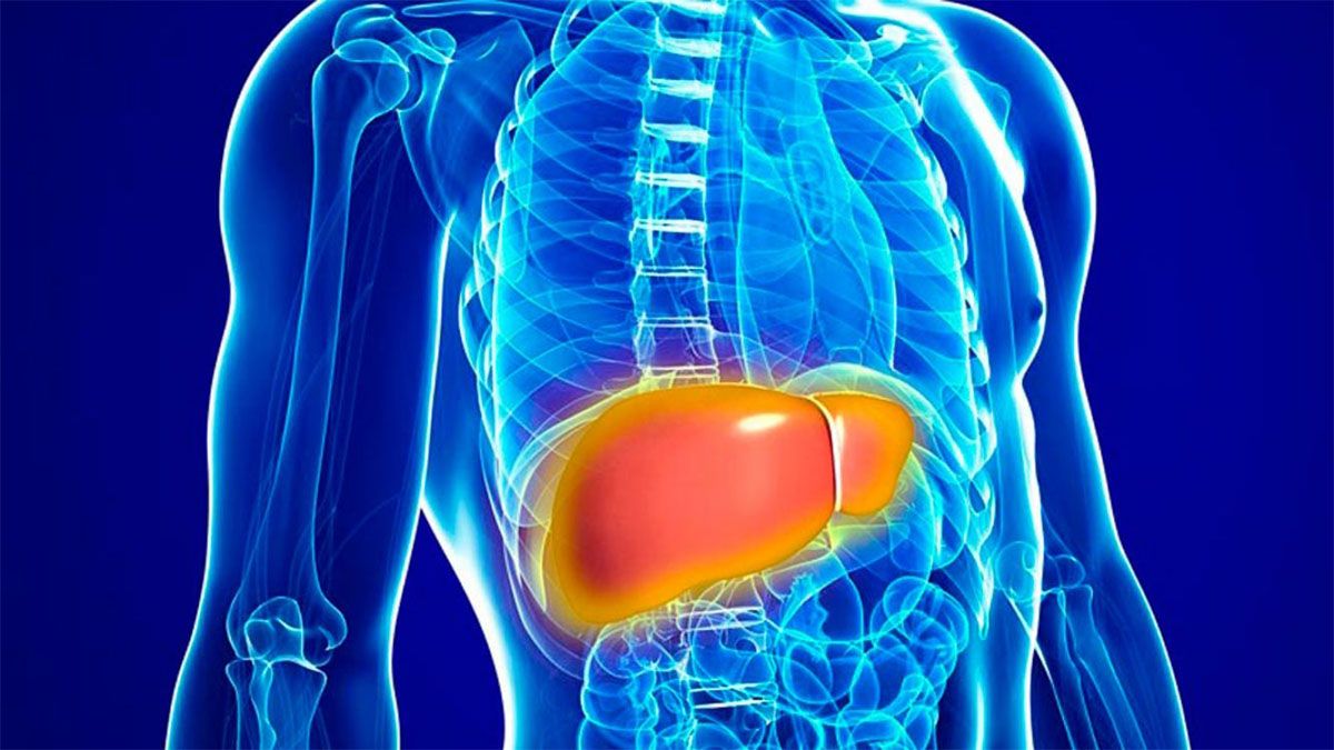 La enfermedad silenciosa: el hígado graso puede causar la muerte