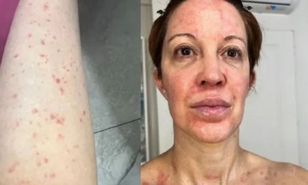 La actriz aseguró que el estrés y las emociones jugaron un rol clave en el cuadro que padeció. La actriz aseguró que el estrés y las emociones jugaron un rol clave en el cuadro que padeció.
