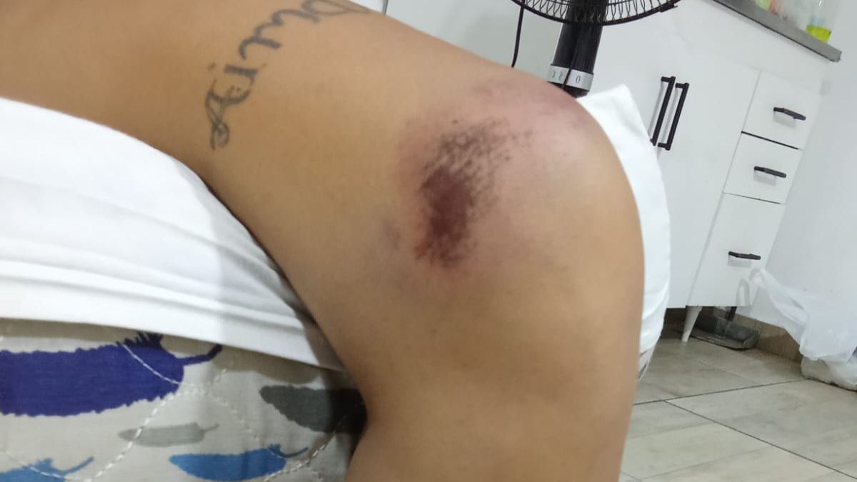 &ldquo;Me empezaron a pegar hasta que solt&eacute; la moto. En un momento me apuntaron con el arma en la cabeza y me contaban hasta tres; si no la soltaba, me iban a pegar un tiro&rdquo;, relat&oacute; la joven.