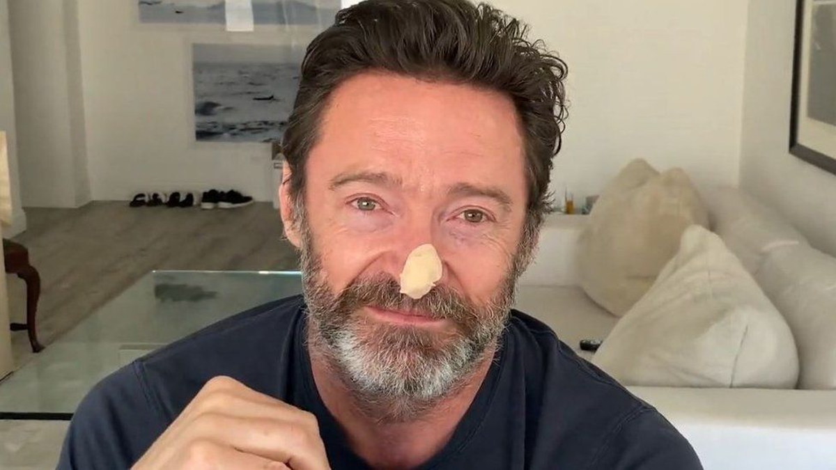 Hugh Jackman revela diagnóstico de cáncer de piel e insta a los fans a cuidarse