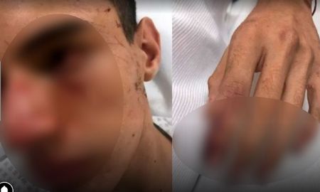 rugbier defendio a una amiga de un abuso sexual y lo molieron a golpes entre 15 rugbier defendio a una amiga de un abuso sexual y lo molieron a golpes entre 15