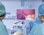 La endoscopia es uno de los estudios de diagnóstico para detectar patologías en el colon. La endoscopia es uno de los estudios de diagnóstico para detectar patologías en el colon.