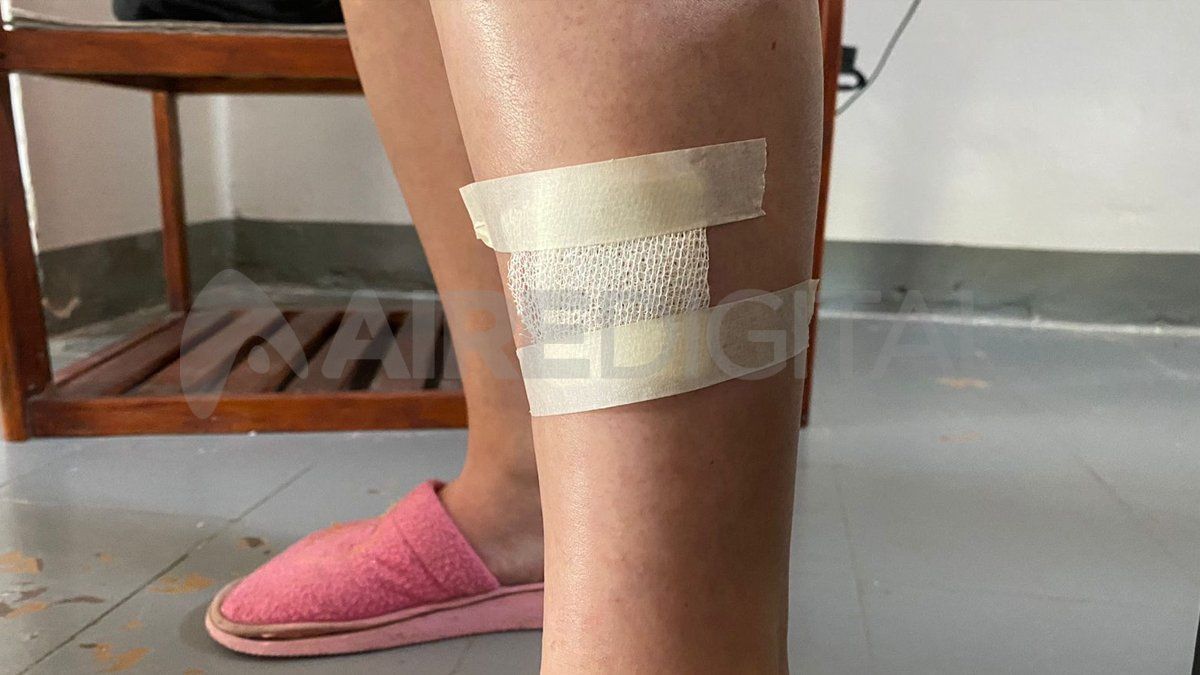 La mujer de 47 años fue trasladada al Hospital Cullen para ser asistida y descartar lesiones graves.