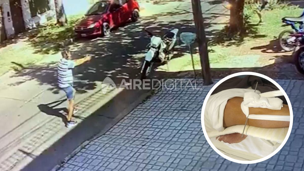 Dieron de alta al joven que balearon para robarle la moto en Fomento 9 de Julio