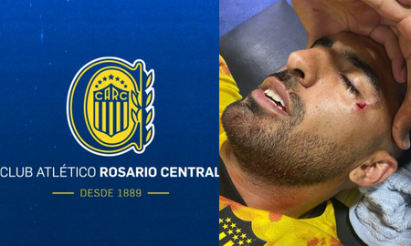 El comunicado oficial de Rosario Central tras la agresión a Maximiliano Olivera. El comunicado oficial de Rosario Central tras la agresión a Maximiliano Olivera.