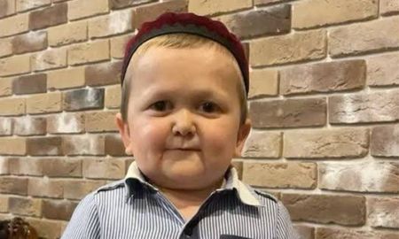 Viral: la extraña enfermedad que hace que un joven se vea como un niño.