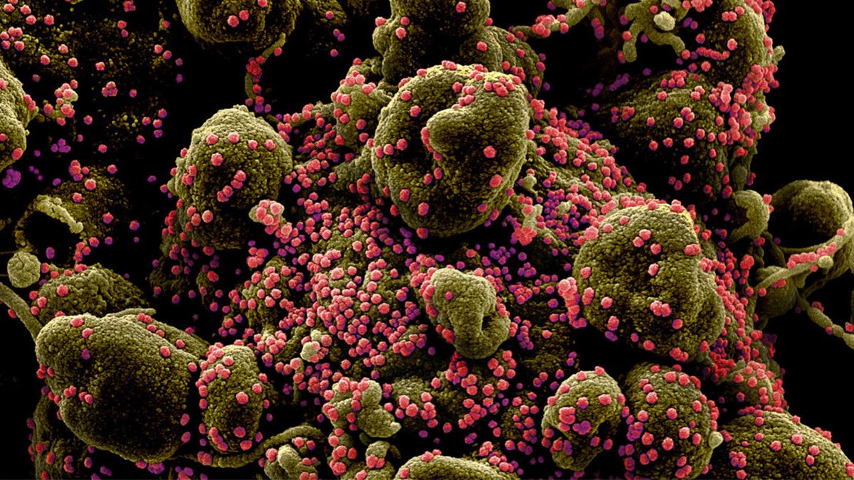 Representaci&oacute;n gr&aacute;fica por ordenador de una c&eacute;lula infectada de covid-19