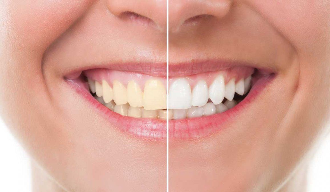 La salud dental es importante para el bienestar general