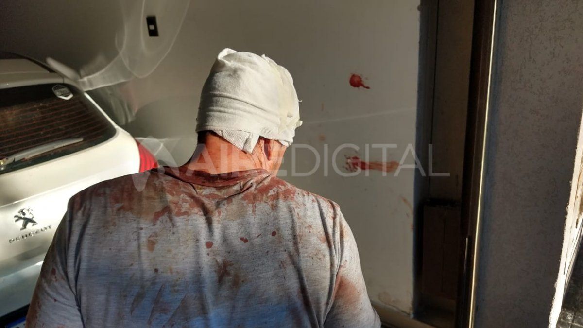 Así quedó el vecino luego de ser atacado a culatazos por el ladrón dentro de la vivienda