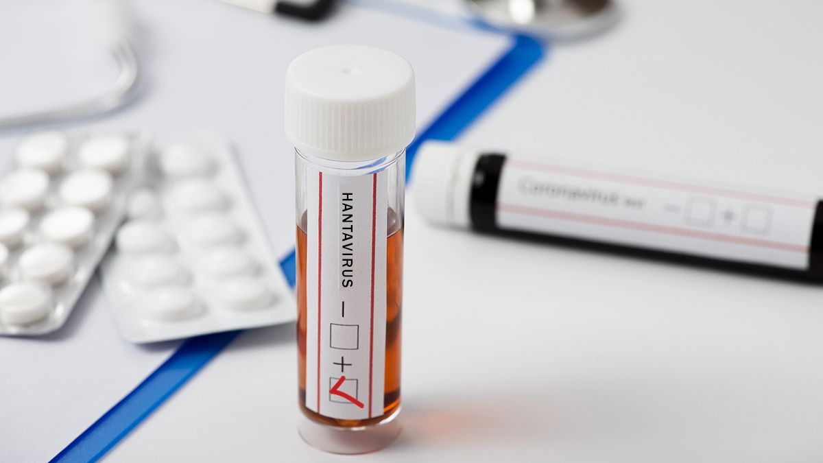 El resultado positivo del análisis por hantavirus se conoció durante el fin de semana.