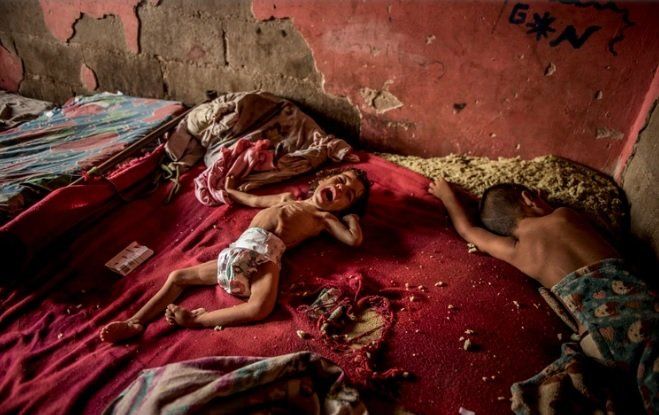 La desgarradora imagen que se convirtió en un símbolo del hambre en Venezuela