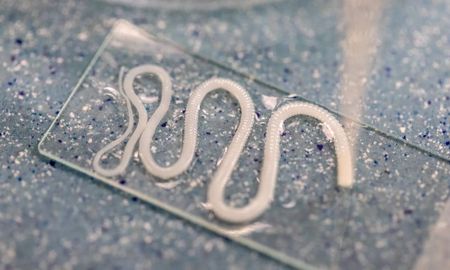 tuvo un asqueroso insecto durante mas de diez anos en su cerebro tuvo un asqueroso insecto durante mas de diez anos en su cerebro