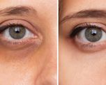 Una especialista en estética compartió una rutina simple con un solo ingrediente vegetal Una especialista en estética compartió una rutina simple con un solo ingrediente vegetal