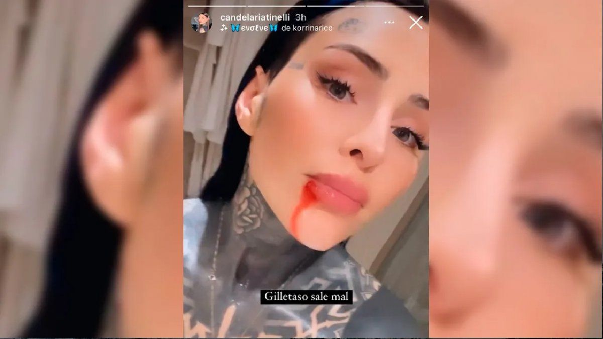 El mal momento de Cande Tinelli por el que denunció maltrato